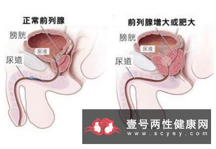 男性爱护阴囊繁衍子孙不用愁 夏季护理阴囊也有好方法