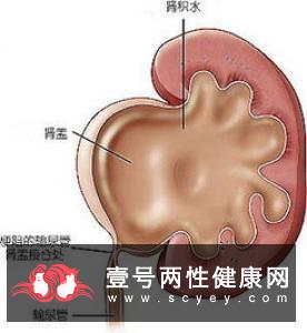 怎样自测睾丸癌 检查的最佳时机是何时