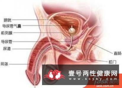 急性膀胱炎的4大症状你了解多少