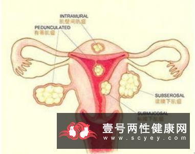 不孕症有什么症状_39健康问答