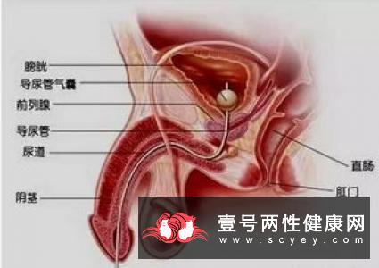 男性睾丸不规则一大一小是为何