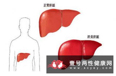 封闭抗体阳性有何意义