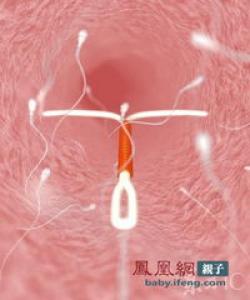 精子在女性体内的存活时间