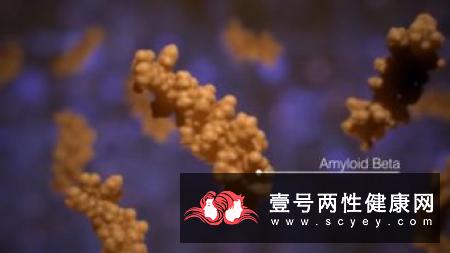 老年痴呆症的治疗方法