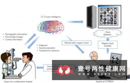 白内障检查与治疗的新进展