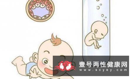 什么是试管婴儿