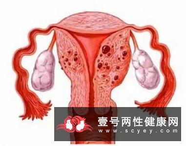 探究卵巢早衰的4大病因