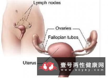 这些是卵巢囊肿的普遍症状