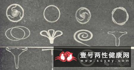 节育环有几种