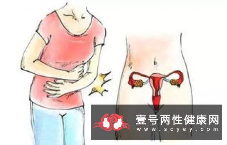 常见的卵巢囊肿患者的病症