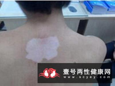 白内障会对患者造成的危害
