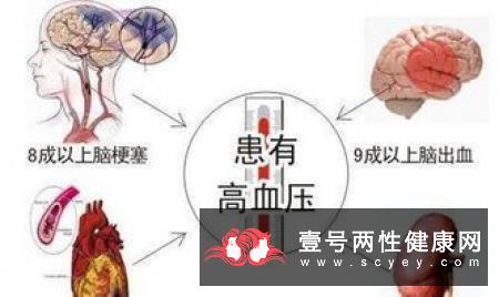 影响老年痴呆疾病的三个因素 你不可不知