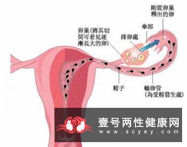 输卵管堵塞是什么原因造成的