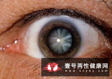 白内障的有关饮食治疗