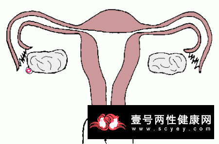 雌性激素低怎么调理