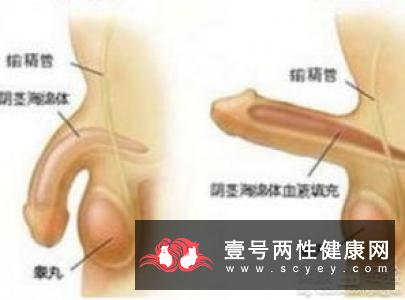 做到这四点有效预防男性性功能障碍