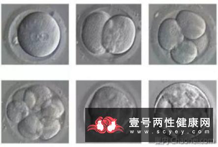 胚胎移植后应该注意什么