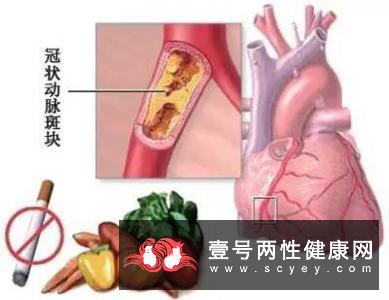 老年人心肌梗塞有什么症状？   如何预防呢？