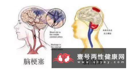 排卵日的症状