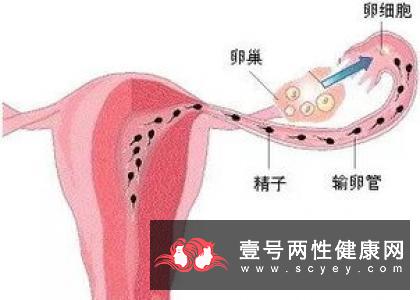 如何在不同时期进行避孕