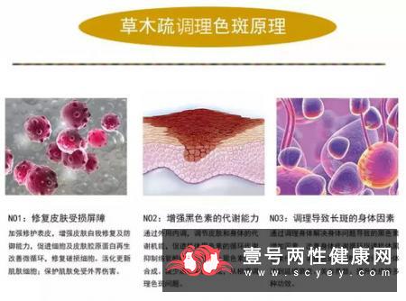 及时就诊老年色斑  皮肤上的色斑与健康关系