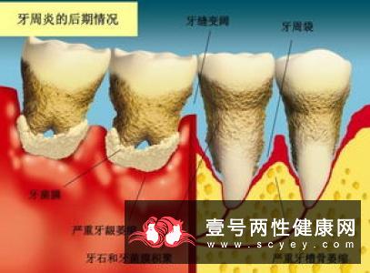 牙齿松动治疗方法？