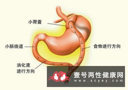 细数牙周炎相关“罪状”